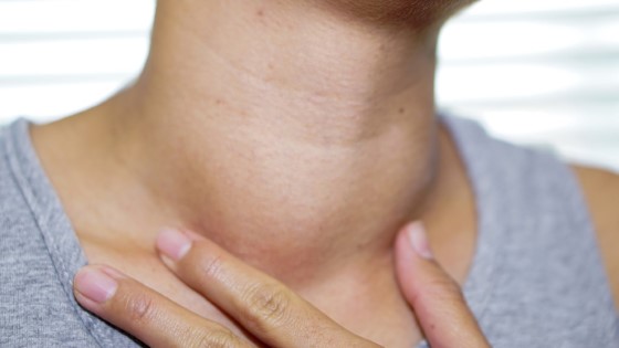 Thyroid Removal and Skin Changes